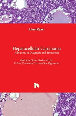 Hepatocellular Carcinoma: Advances in Diagnosis and Treatment by Streba, Costin Teodor