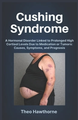 Cushing Syndrome: A Hormonal Disorder Linked to Prolonged High Cortisol Levels Due to Medication or Tumors: Causes, Symptoms, and Prognosis by Hawthorne, Theo