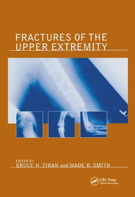 Fractures of the Upper Extremity by Ziran, Bruce H.