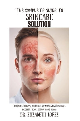 The Complete Guide to Skincare Solution: A Comprehensive Approach To Managing Psoriasis, Eczema, Acne, Rosacea and Aging by Lopez, Elizabeth