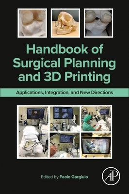 Handbook of Surgical Planning and 3D Printing: Applications, Integration, and New Directions by Gargiulo, Paolo