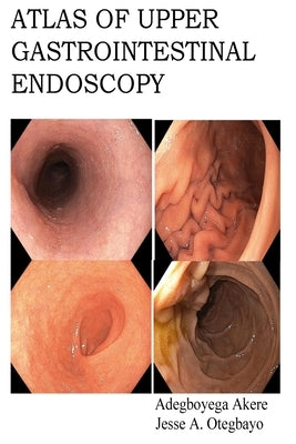 Atlas of Upper Gastrointestinal Endoscopy by Otegbayo, Jesse Abiodun