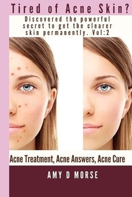 TIRED OF ACNE SKIN? Discover the Powerful Secrets to get Clearer Skin Permanently by Morse, Amy D.