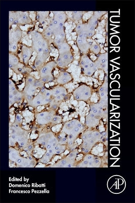 Tumor Vascularization by Ribatti, Domenico