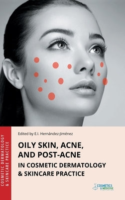 Oily Skin, Acne, and Post-Acne in Cosmetic Dermatology & Skincare Practice by Hernandez-Jimenez, Elena