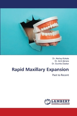 Rapid Maxillary Expansion by Kokate, Akshay