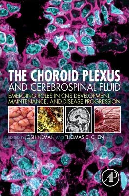 The Choroid Plexus and Cerebrospinal Fluid: Emerging Roles in CNS Development, Maintenance, and Disease Progression by Neman, Josh