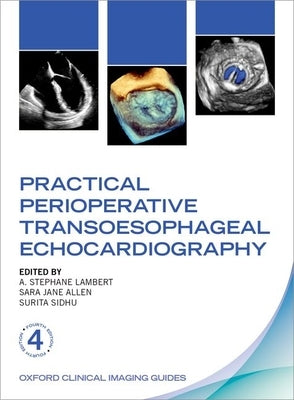 Practical Perioperative Transoesophageal Echocardiography by Lambert, A. Stephane