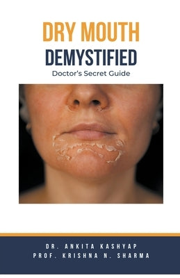 Dry mouth Demystified: Doctor's Secret Guide by Kashyap, Ankita
