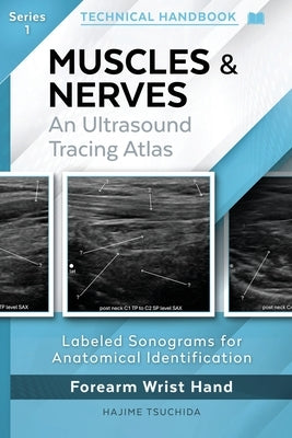 Muscles & Nerves - Technical Ultrasound Handbook: An Ultrasound Tracing Atlas (Series 1) by Tsuchida, Hajime