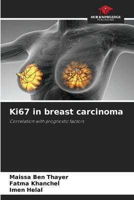 Ki67 in breast carcinoma by Ben Thayer, Maissa