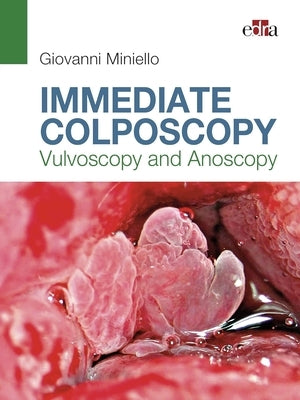 Immediate Colposcopy - Vulvoscopy and Anoscopy by Miniello, Giovanni