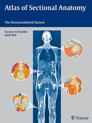 Atlas of Sectional Anatomy: The Musculoskeletal System by Möller, Torsten Bert