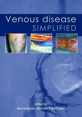 Venous Disease Simplified by Davies, Alun H.