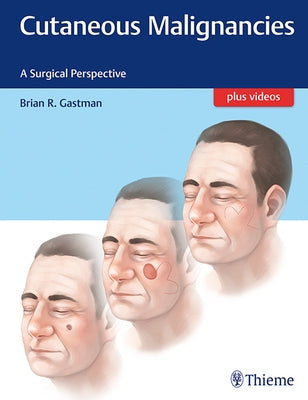 Cutaneous Malignancies: A Surgical Perspective by Gastman, Brian