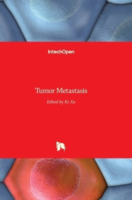 Tumor Metastasis by Xu, Ke