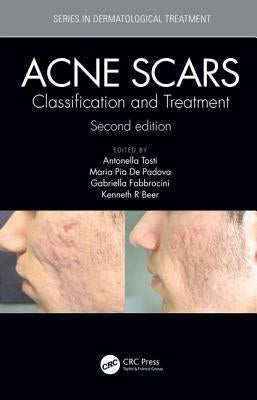 Acne Scars: Classification and Treatment, Second Edition by Tosti, Antonell