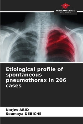 Etiological profile of spontaneous pneumothorax in 206 cases by Abid, Narjes
