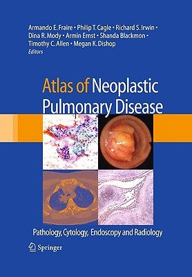 Atlas of Neoplastic Pulmonary Disease: Pathology, Cytology, Endoscopy and Radiology by Fraire, Armando E.