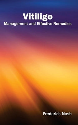 Vitiligo: Management and Effective Remedies by Nash, Frederick