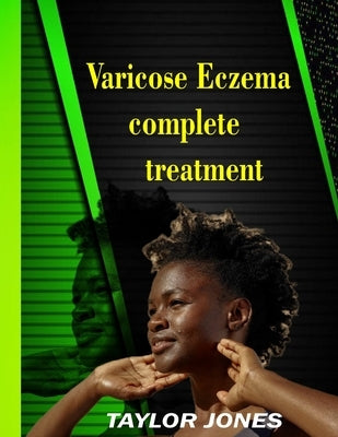 Varicose eczema Complete treatment: treatment to eczema skin disease by Jones, Taylor