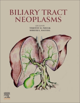 Biliary Tract Neoplasms by Pawlik, Timothy M.