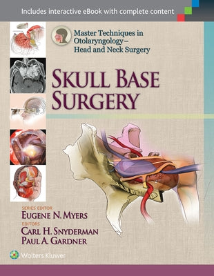 Master Techniques in Otolaryngology - Head and Neck Surgery: Skull Base Surgery by Snyderman, Carl