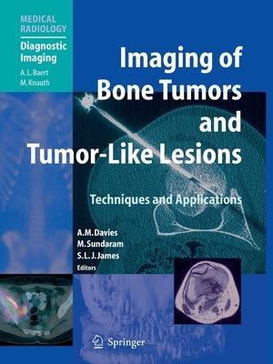 Imaging of Bone Tumors and Tumor-Like Lesions: Techniques and Applications by Davies, A. Mark