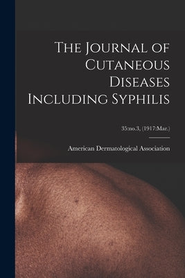 The Journal of Cutaneous Diseases Including Syphilis; 35: no.3, (1917: Mar.) by American Dermatological Association