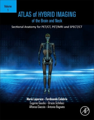 Atlas of Hybrid Imaging of the Brain and Neck, Volume 1: Sectional Anatomy for Pet/Ct, Pet/MRI and Spect/CT by Leporace, Mario