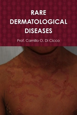 Rare Dermatological Diseases by Di Cicco, Prof Camillo O.