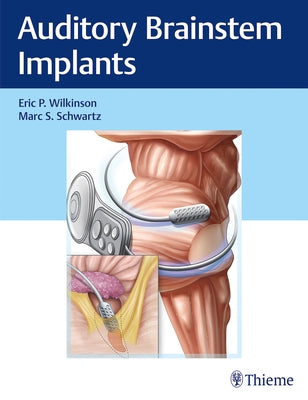 Auditory Brainstem Implants by Wilkinson, Eric P.