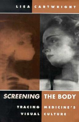 Screening the Body: Tracing Medicine's Visual Culture by Cartwright, Lisa