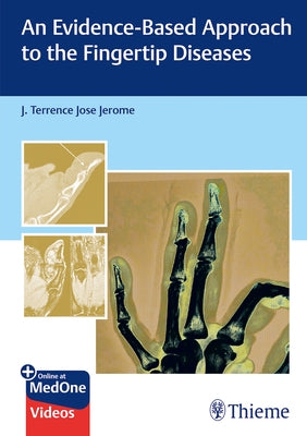 An Evidence-Based Approach to the Fingertip Diseases by Jerome, J. Terrence