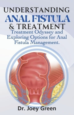Understanding Anal Fistula & Treatment: Treatment Odyssey and Exploring Options for Anal Fistula Management. by Green, Joey