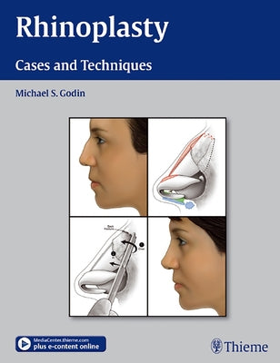 Rhinoplasty: Cases and Techniques by Godin, Michael S.