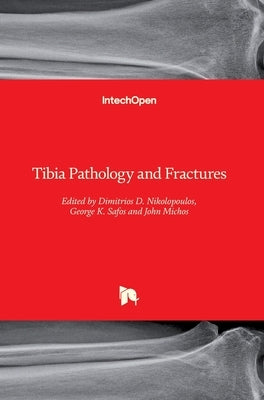 Tibia Pathology and Fractures by Nikolopoulos, Dimitrios D.