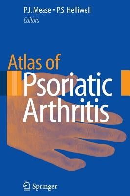 Atlas of Psoriatic Arthritis by Mease, Philip J.