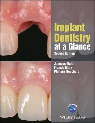 Implant Dentistry at a Glance by Malet, Jacques