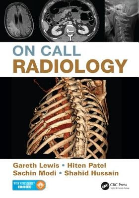 On Call Radiology by Lewis, Gareth