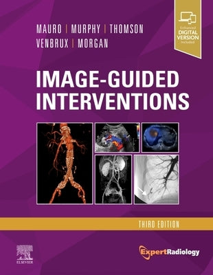 Image-Guided Interventions: Expert Radiology Series by Thomson, Kenneth R.