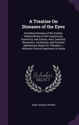 A Treatise On Diseases of the Eyes: Including Diseases of the Eyelids, Inflammations of the Conjunctiva, Sclerotica, and Cornea, Also, Catarrhal, Rheu by Peters, John Charles