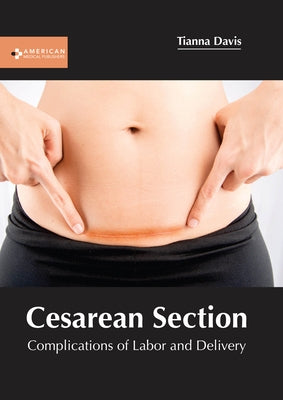 Cesarean Section: Complications of Labor and Delivery by Davis, Tianna
