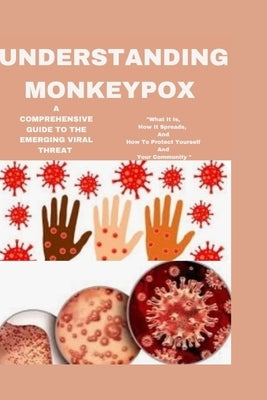 Understanding Monkeypox: A Comprehensive Guide to the Emerging Viral Threat: "What It Is, How It Spreads, and How to Protect Yourself and Your by Sinclear, Ava