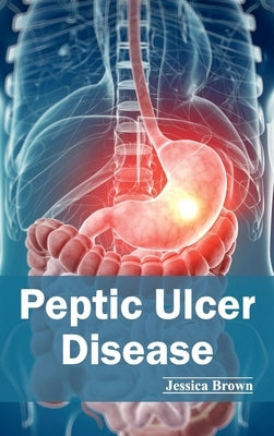 Peptic Ulcer Disease by Brown, Jessica
