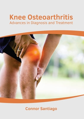 Knee Osteoarthritis: Advances in Diagnosis and Treatment by Santiago, Connor
