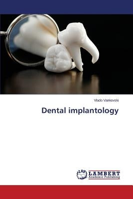 Dental implantology by Vankovski Vlado