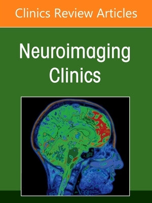 Management and Treatment of Cerebral Aneurysms, an Issue of Neuroimaging Clinics of North America: Volume 35-3 by Sahlein, Daniel