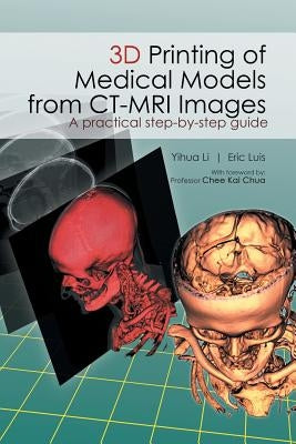 3D Printing of Medical Models from CT-MRI Images: A Practical step-by-step guide by Li Yihua