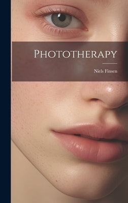 Phototherapy by Finsen, Niels